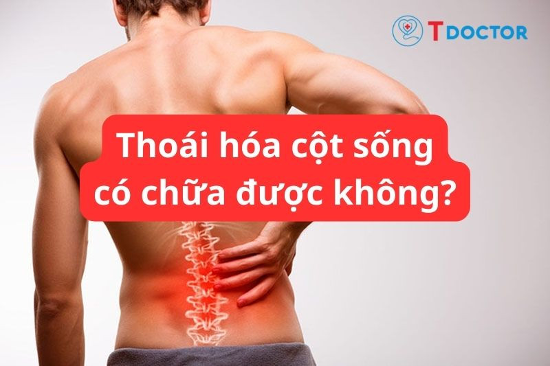 Bệnh thoái hóa cột sống có chữa được không? Bệnh thoái hóa cột sống có chữa được không?