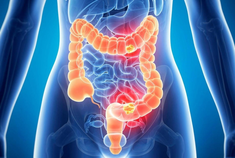 Thải độc đại tràng Detoxify - “Công thần” thải độc cơ thể, giúp nâng cao sức khỏe toàn diện  Thải độc đại tràng Detoxify - “Công thần” thải độc cơ thể, giúp nâng cao sức khỏe toàn diện