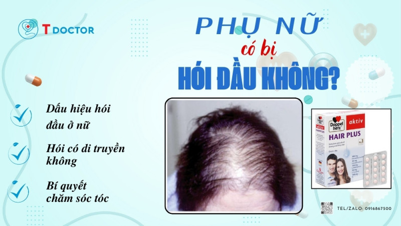 Bệnh hói đầu là một vấn đề thường gặp ở cả nam và nữ, tuy nhiên, nó lại có những dấu hiệu và nguyên nhân khác nhau giữa hai giới. Trong đó, phụ nữ có xu hướng bị hói đầu nhiều hơn nam giới do nhiều yếu tố như di truyền, sức khỏe, chế độ dinh dưỡng và chăm sóc tóc. Vậy phụ nữ có bị hói đầu không? Có những dấu hiệu nào để nhận biết bệnh hói đầu ở nữ? Và cách chữa trị bệnh này như thế nào? Hãy cùng tìm hiểu trong bài viết này.