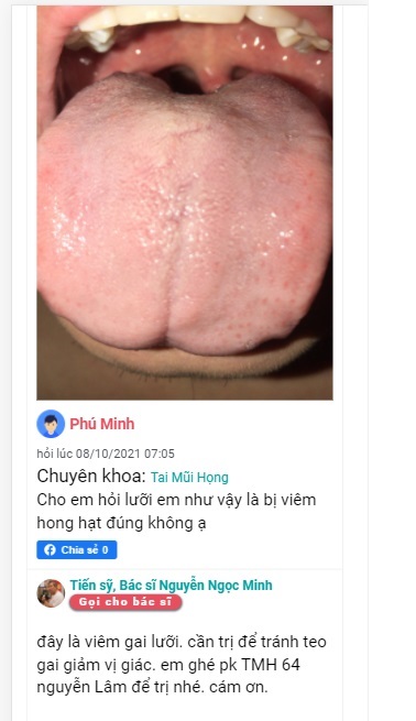 Hình ảnh đánh giá 14